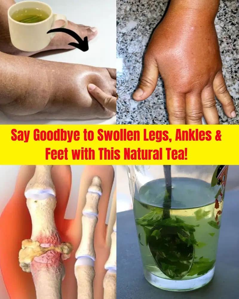 Say Goodbye to Swollen Legs, Ankles & Feet with This Natural Tea!