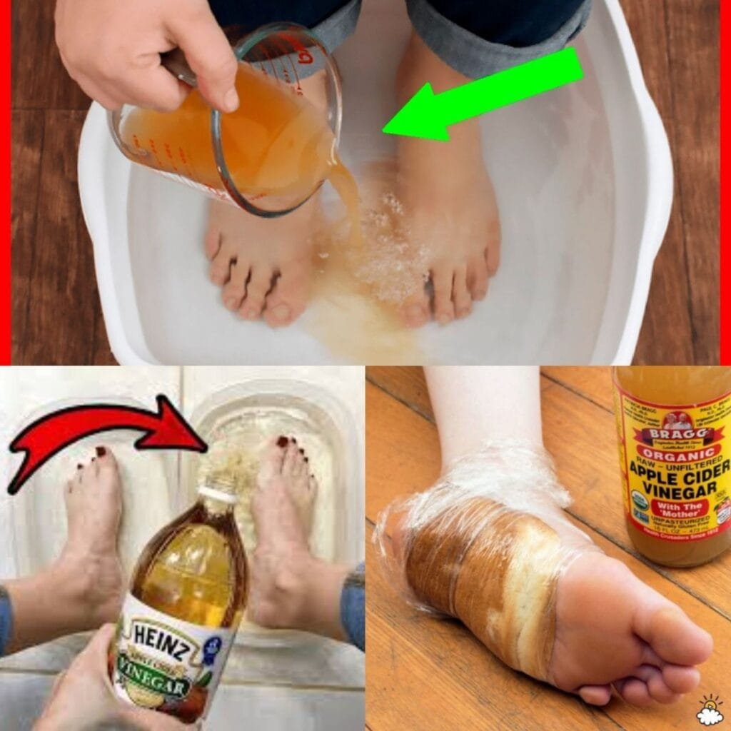 Make Your Own Apple Cider Vinegar Detox Soak to Rejuvenate Your Feet