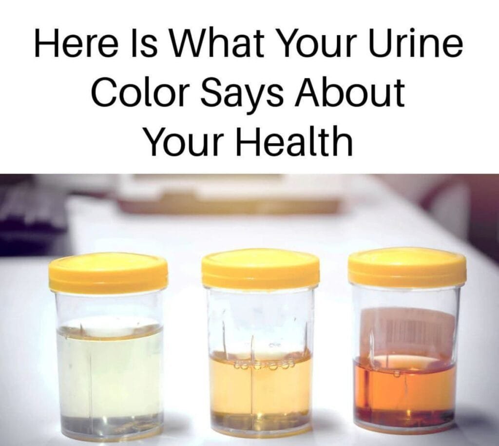 What Your Urine Color Says About Your Health