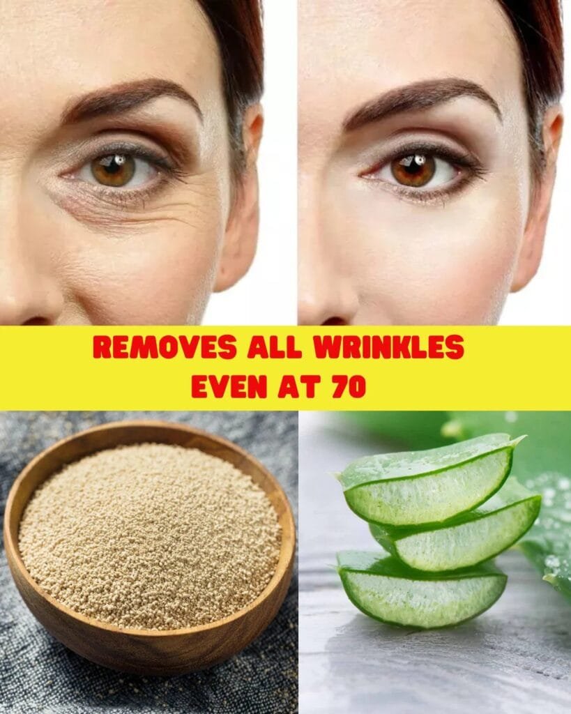 Yeast with Aloe Vera Removes All Wrinkles! Use It on Your Skin – Even at 70!