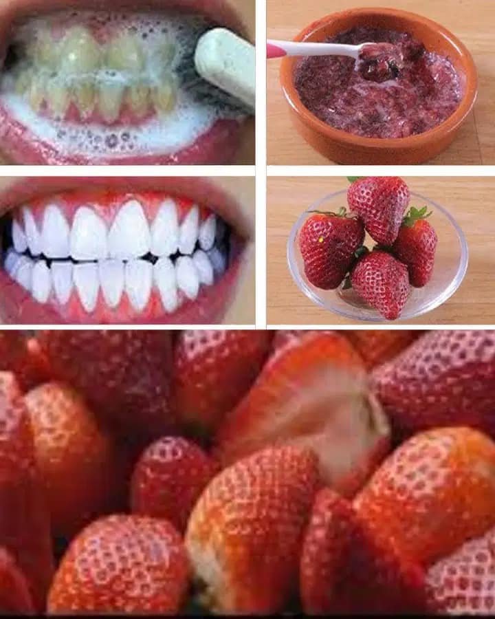 Strawberries and Baking Soda: A Natural Teeth Whitening Remedy