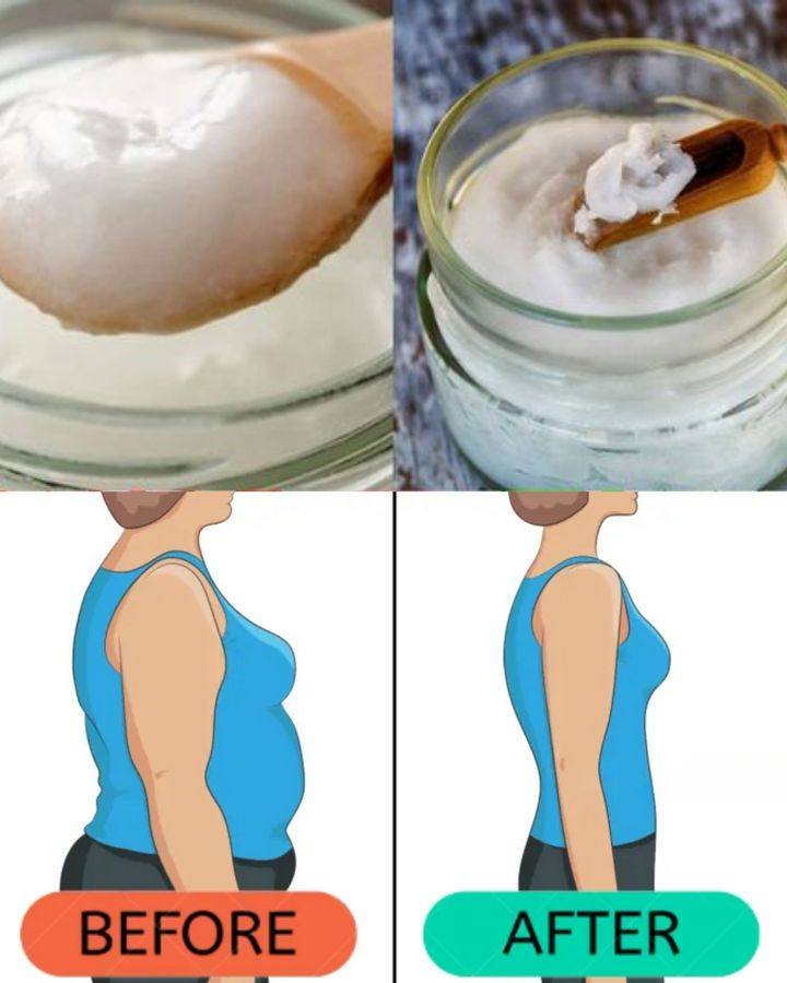 Coconut Oil: A Versatile and Surprising Health Booster