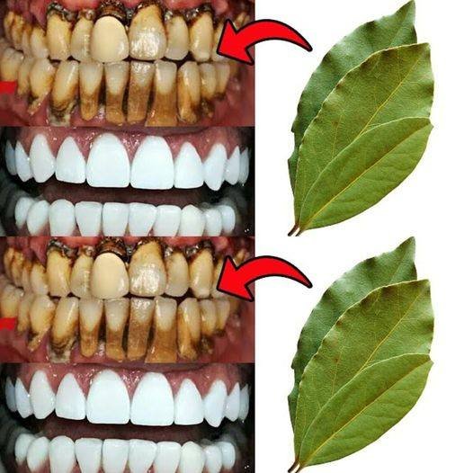 Secrets Your Dentist Wants You to Know: Empowering Dental Health
