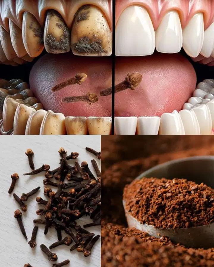 9 Natural Ways to Remove Plaque & Tartar Buildup.