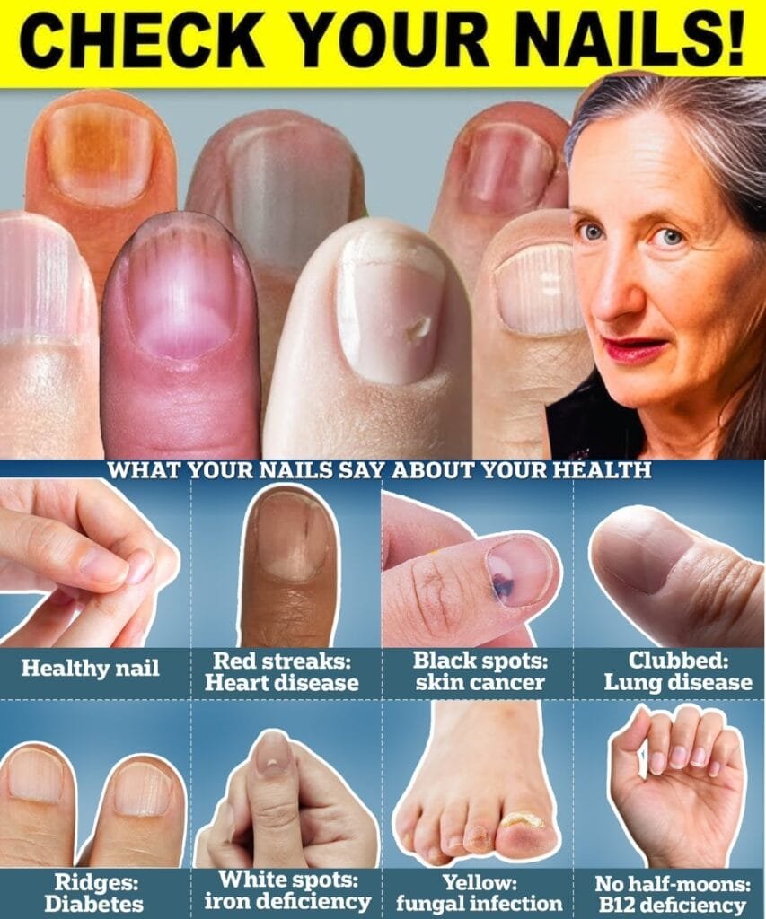 9 Things Your Nails Can Tell You About Your Health