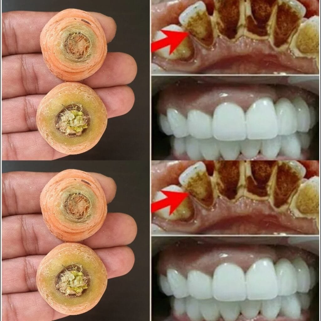 Whiten Your Teeth Naturally in 2 Minutes!Carrot Tops: A Surprising Home Remedy for a Bright Smile