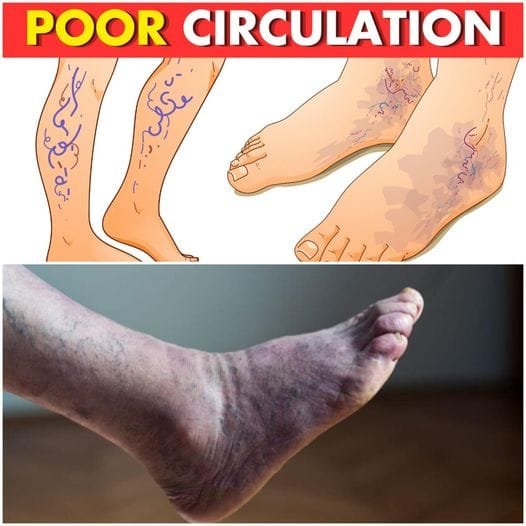 5 Warning Signs of Poor Circulation and How to Improve It Naturally