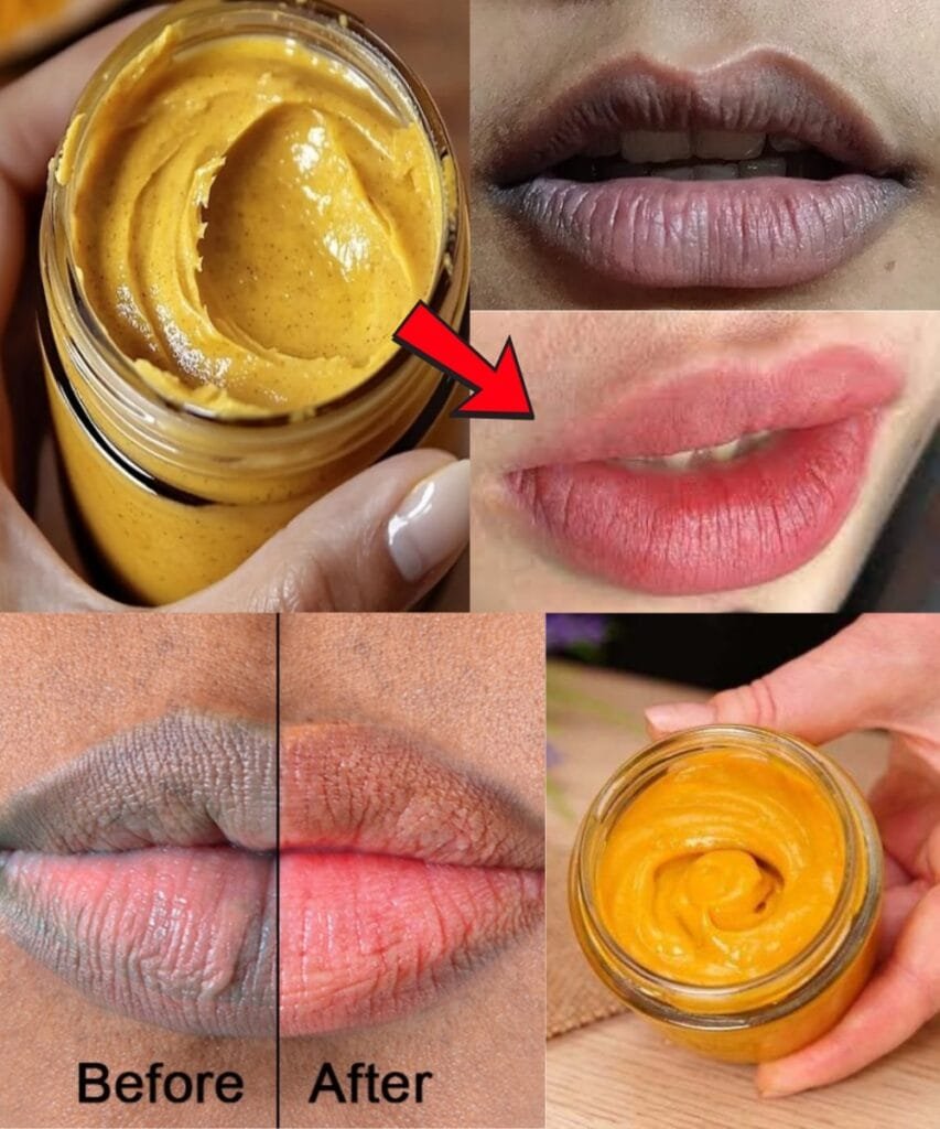 Top remedies to get rid of dark lips