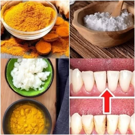 Remove Tartar and Plaque at Home Without a Dentist: Turmeric and Salt – The Ultimate DIY Solution